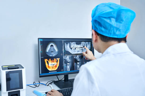 Best Knocked-Out Tooth (Avulsed Tooth) Treatment in Moss Bluff, LA